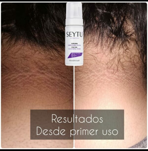 ESPUMA LIMPIADORA FACIAL - Image 5
