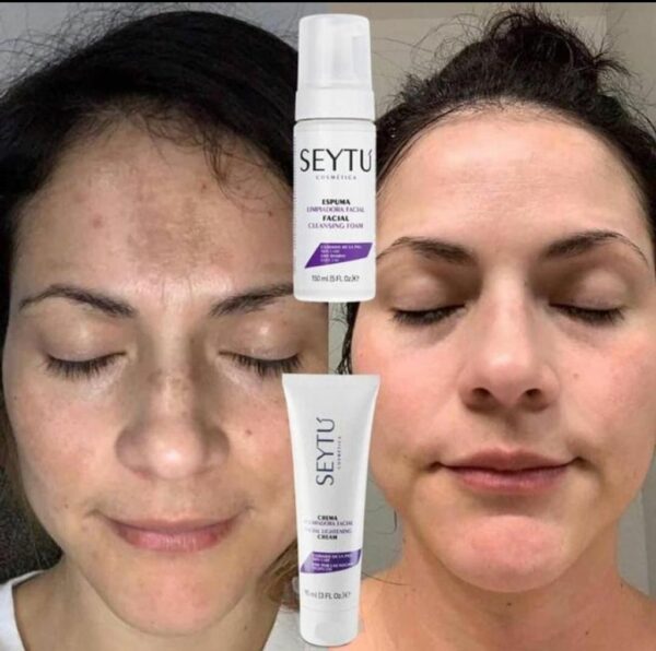 *Espuma Limpiadora* ✅ Remueve impurezas ✅ Enriquecido con Moringa y Aloe Vera. *Crema Aclaradora* ✅ Uva Ursi: Brinda aclarado de manchas. ✅ Acido Glicólico: Elimina células muertas y regenera la piel. *Crema facial de día - Fps 20* ✅ Contiene una rica variedad de proteinas y extractos hidrolizados ( trigo, soya, maiz y avena ) que ayudan como reafirmante y acondicionadores de la piel.